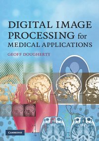 Digital Image Processing for Medical Applications (inbunden)