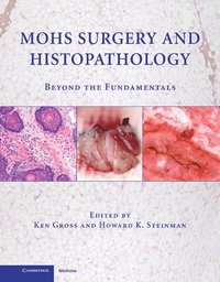 Mohs Surgery and Histopathology (inbunden)