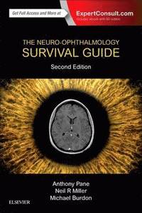 The Neuro-Ophthalmology Survival Guide (hftad)
