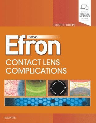 Contact Lens  Complications (inbunden)