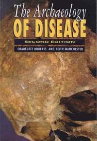 The Archaeology of Disease (hftad)