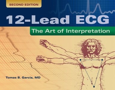 12-Lead ECG: the Art of Interpretation (häftad)