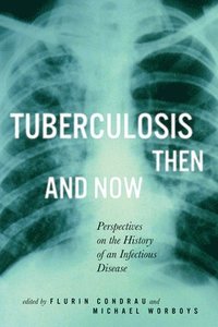 Tuberculosis Then and Now: Volume 37 (inbunden)