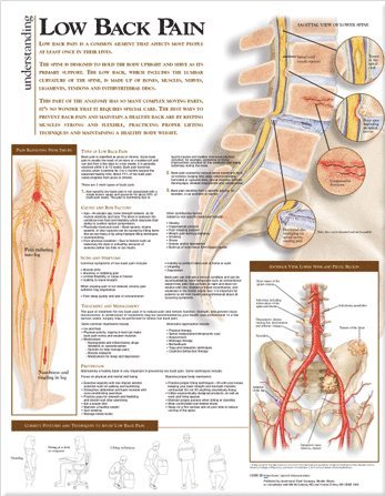 Understanding Low Back Pain Anatomical Chart (h�ftad)