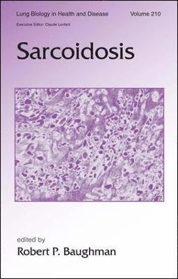 Sarcoidosis (inbunden)