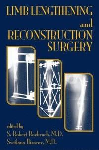 Limb Lengthening and Reconstruction Surgery (inbunden)
