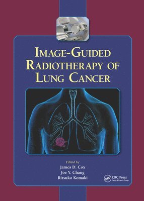 Image-Guided Radiotherapy of Lung Cancer (inbunden)