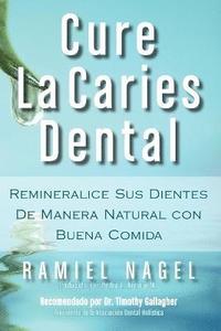 Cure La Caries Dental (hftad)