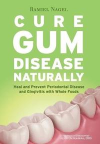 Cure Gum Disease Naturally (häftad)