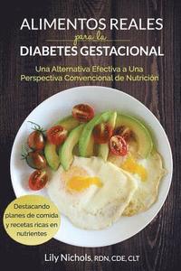 Alimentos Reales Para La Diabetes Gestacional: Una Alternativa Efectiva a Una Perspectiva Convencional de Nutrición (häftad)