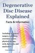 Degenerative Disc Disease Explained. Including treatment, surgery, symptoms, exercises, causes, physical therapy, neck, back, pain, and much more! Facts &; Information