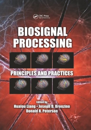 Biosignal Processing (e-bok)