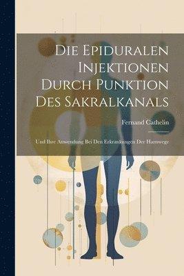 Epiduralen Injektionen Durch Punktion Des Sakralkanals (inbunden)