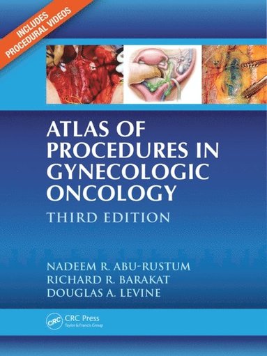 Atlas of Procedures in Gynecologic Oncology (häftad)
