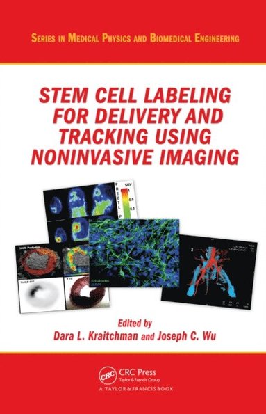Stem Cell Labeling for Delivery and Tracking Using Noninvasive Imaging ...