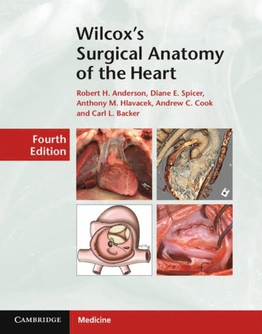 Wilcox's Surgical Anatomy of the Heart (hftad)