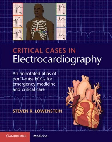 Critical Cases in Electrocardiography (häftad)