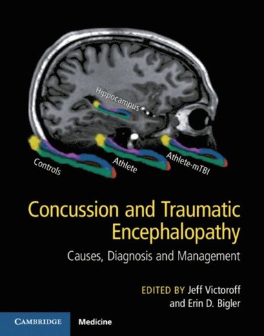 Concussion and Traumatic Encephalopathy (e-bok)