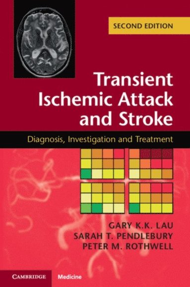 Transient Ischemic Attack and Stroke (e-bok)
