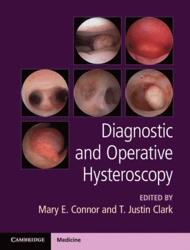 Diagnostic and Operative Hysteroscopy (inbunden)