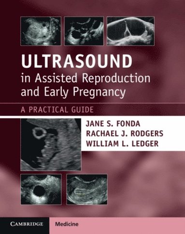 Ultrasound in Assisted Reproduction and Early Pregnancy (e-bok)