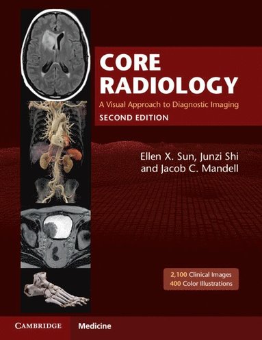Core Radiology (inbunden)