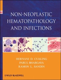 Non-Neoplastic Hematopathology and Infections (e-bok)