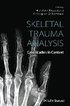 Skeletal Trauma Analysis