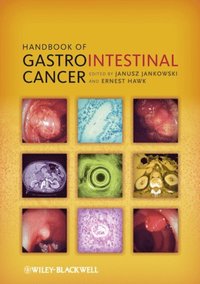 Handbook of Gastrointestinal Cancer (e-bok)