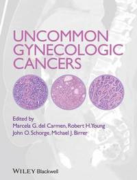 Uncommon Gynecologic Cancers (inbunden)