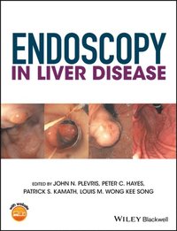 Endoscopy in Liver Disease (e-bok)