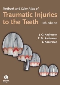 Textbook and Color Atlas of Traumatic Injuries to the Teeth (e-bok)