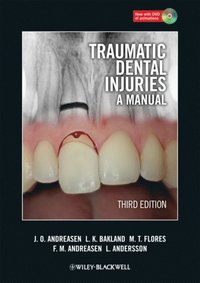 Traumatic Dental Injuries (e-bok)