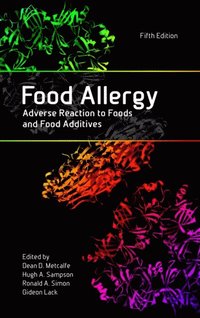 Food Allergy (e-bok)