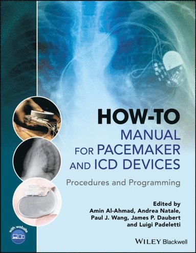 How-to Manual for Pacemaker and ICD Devices (e-bok)