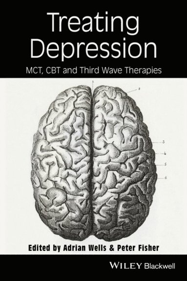 Treating Depression (e-bok)