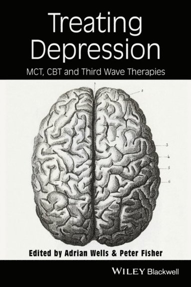 Treating Depression (häftad)