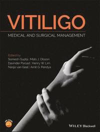 Vitiligo (inbunden)