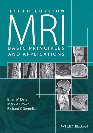 MRI (e-bok)