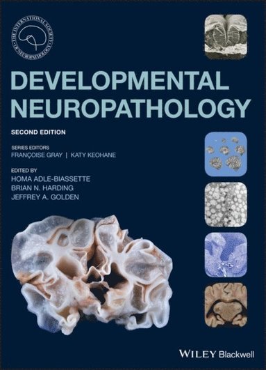 Developmental Neuropathology (e-bok)