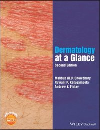 Dermatology At A Glance Mahbub M U Chowdhury Ruwani P Katugampola Andrew Y Finlay Ebok Bokus