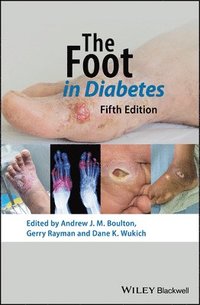 The Foot in Diabetes (inbunden)