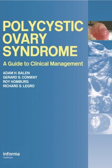 Polycystic Ovary Syndrome (inbunden)