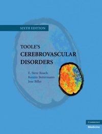 Toole's Cerebrovascular Disorders (e-bok)
