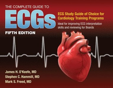 Complete Guide to ECGs: a Comprehensive Study Guide to Improve ECG Interpretation Skills (inbunden)
