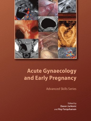 Acute Gynaecology and Early Pregnancy (e-bok)