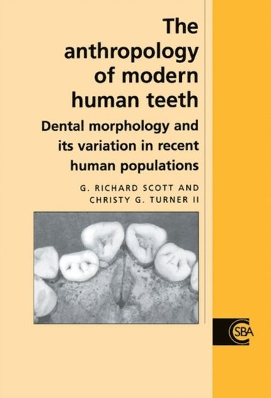 Anthropology of Modern Human Teeth (inbunden)
