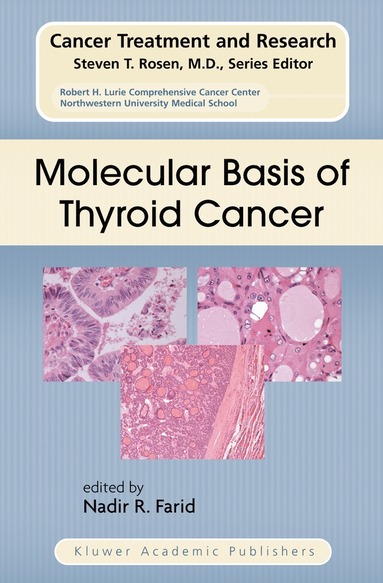 Molecular Basis of Thyroid Cancer (hftad)