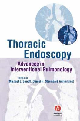 Thoracic Endoscopy (inbunden)