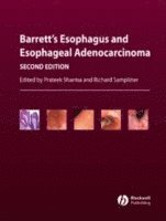 Barrett's Esophagus and Esophageal Adenocarcinoma (inbunden)